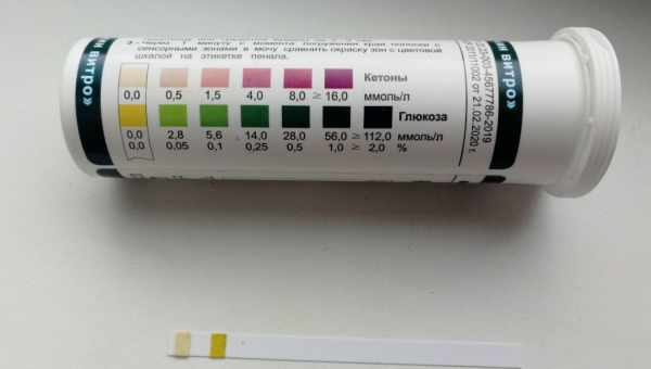 Появление кетоновых тел в моче при беременности